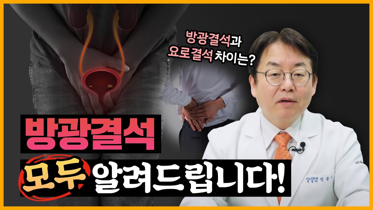 [민승기박사의 비뇨기이야기]방광결석 모두 알려드립니다!_이미지