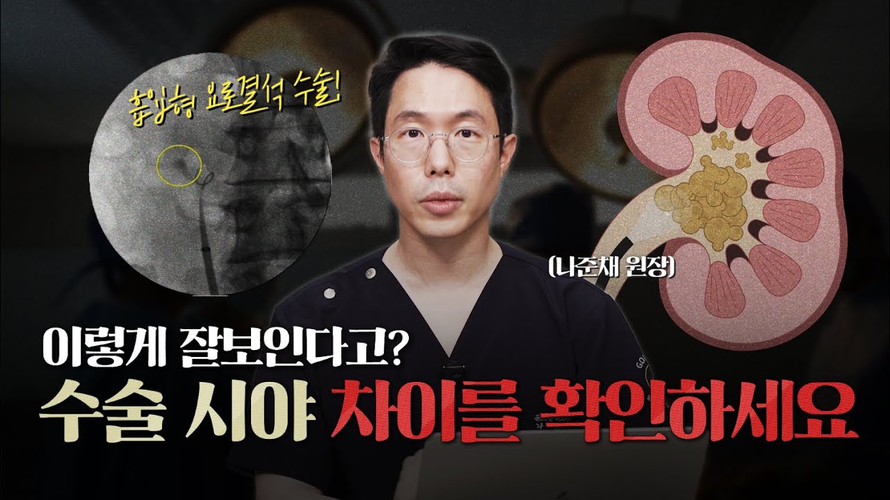 흡입형 요로결석 수술 장비를 사용했더니 이렇게 시야가 확보된다고? FANS를 이용한 결석 수술 사례_이미지