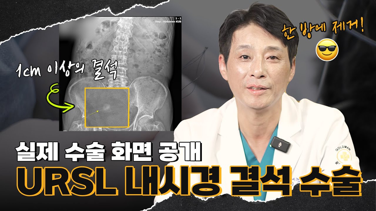 요로결석을 내시경 수술로 해결합니다! 실제 수술 화면과 함께 설명해드리는 URSL_이미지