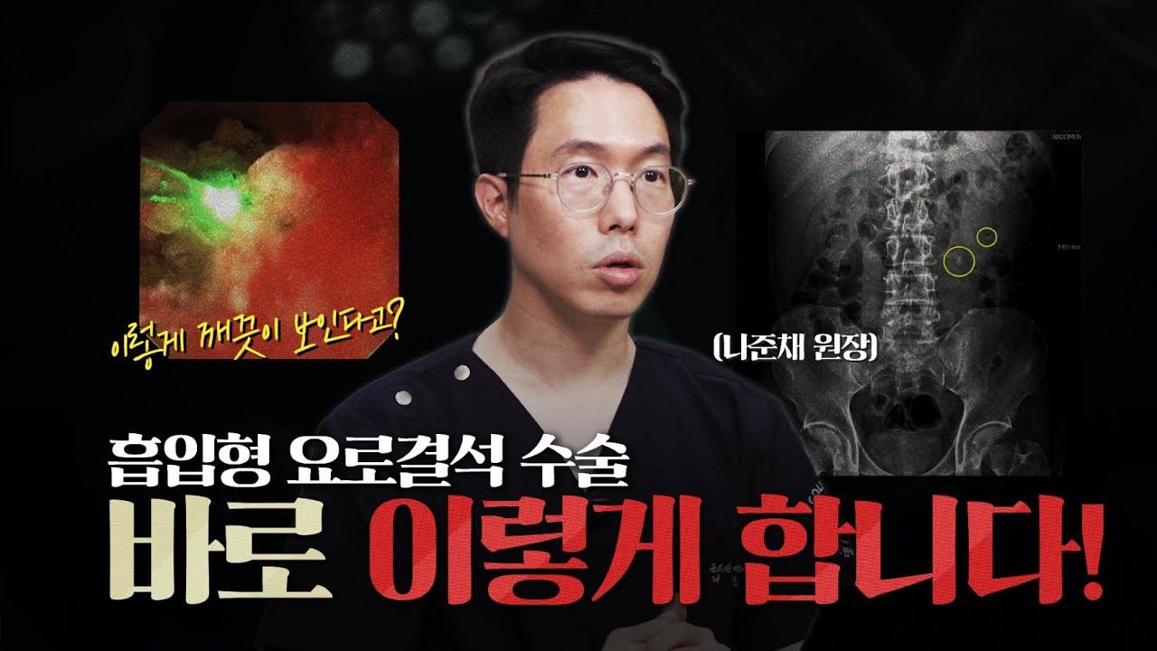 흡입형 요로결석 궁금했던 분들 주목! 실제 수술 영상으로 보여드립니다