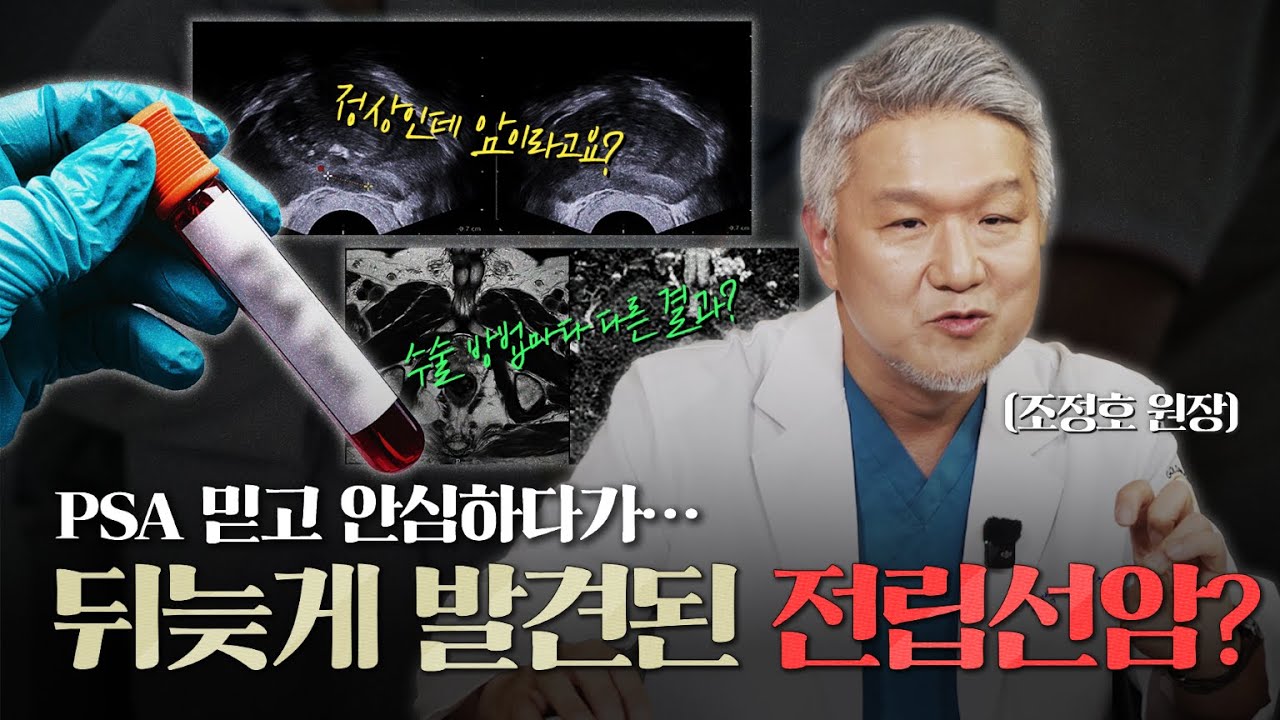 전립선암, PSA 수치가 낮으면 안심해도된다? 뒤늦게 발견된 전립선암 케이스? PSA와 전립선암 전격해부_이미지