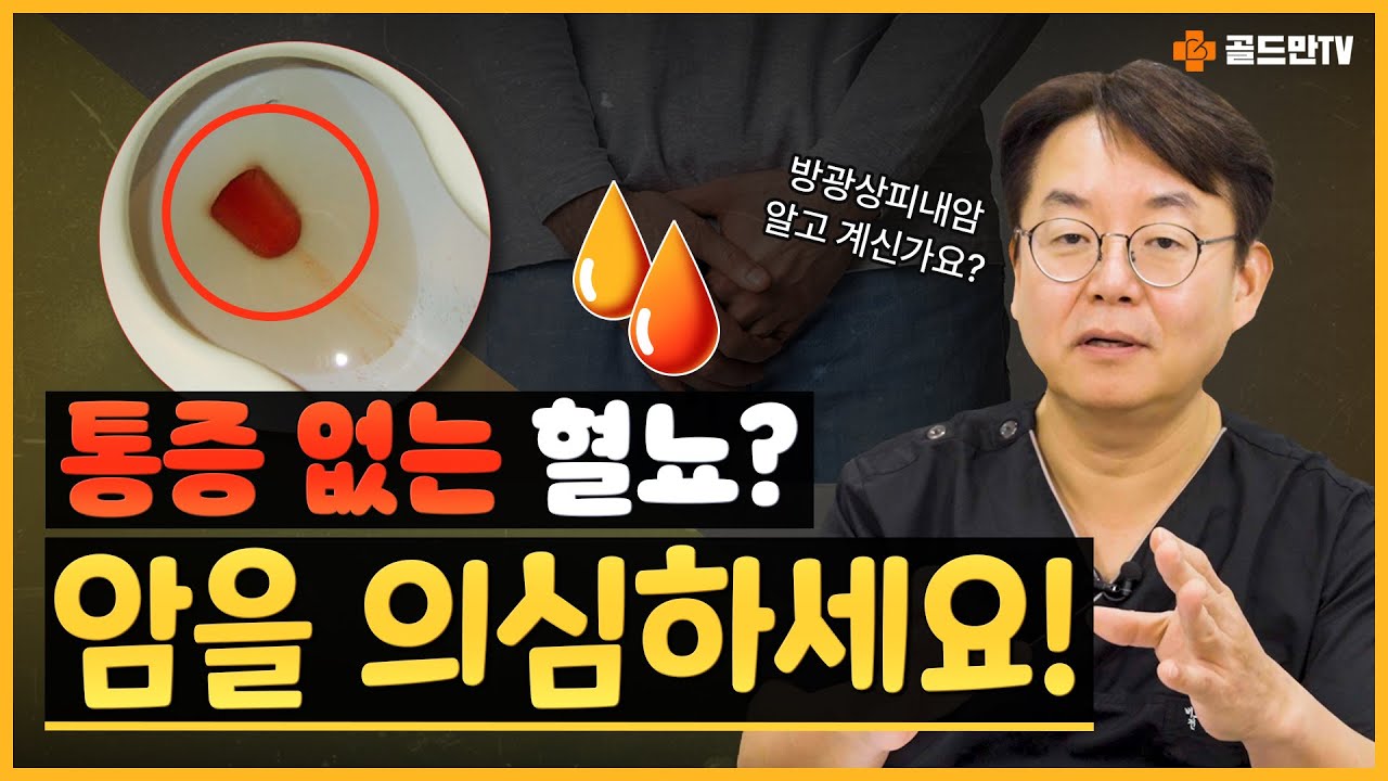 방광 상피에 암이 생기는 이 질환, 알고 계셨나요? ?_이미지