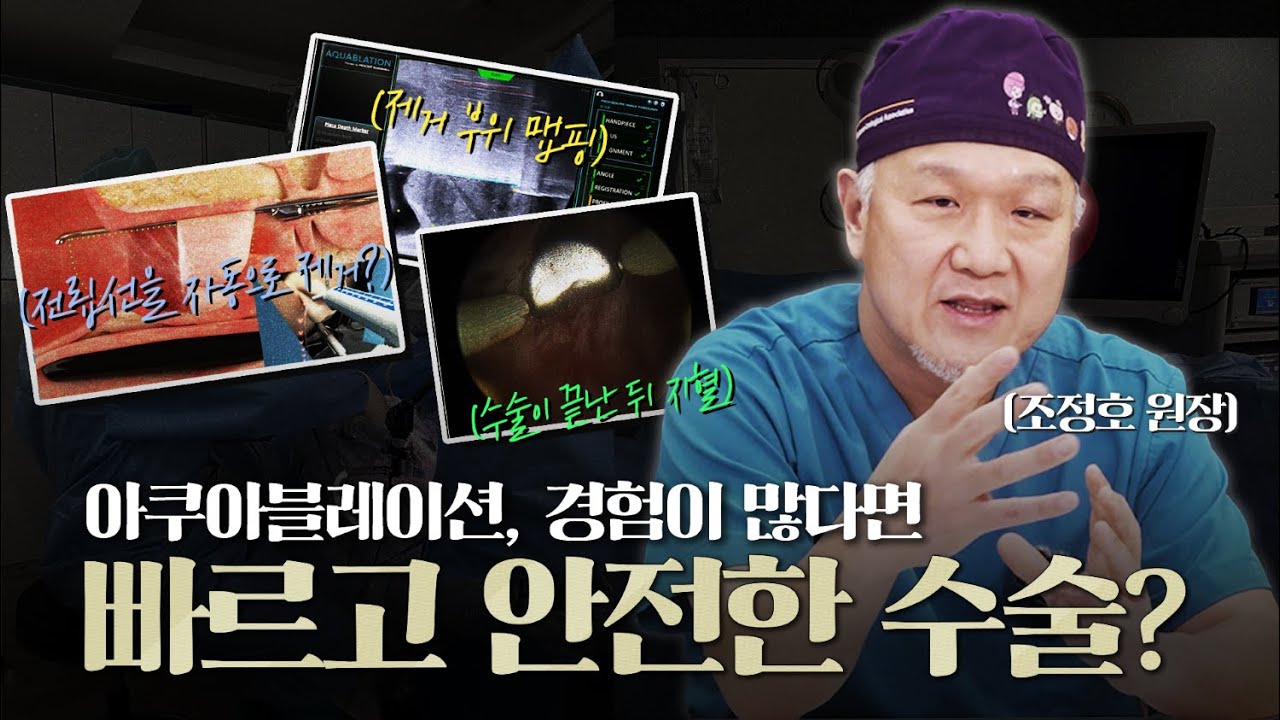 아쿠아블레이션, 경험이 많다면 빠르고 안전한 수술 가능? (로봇 워터젯수술)_이미지