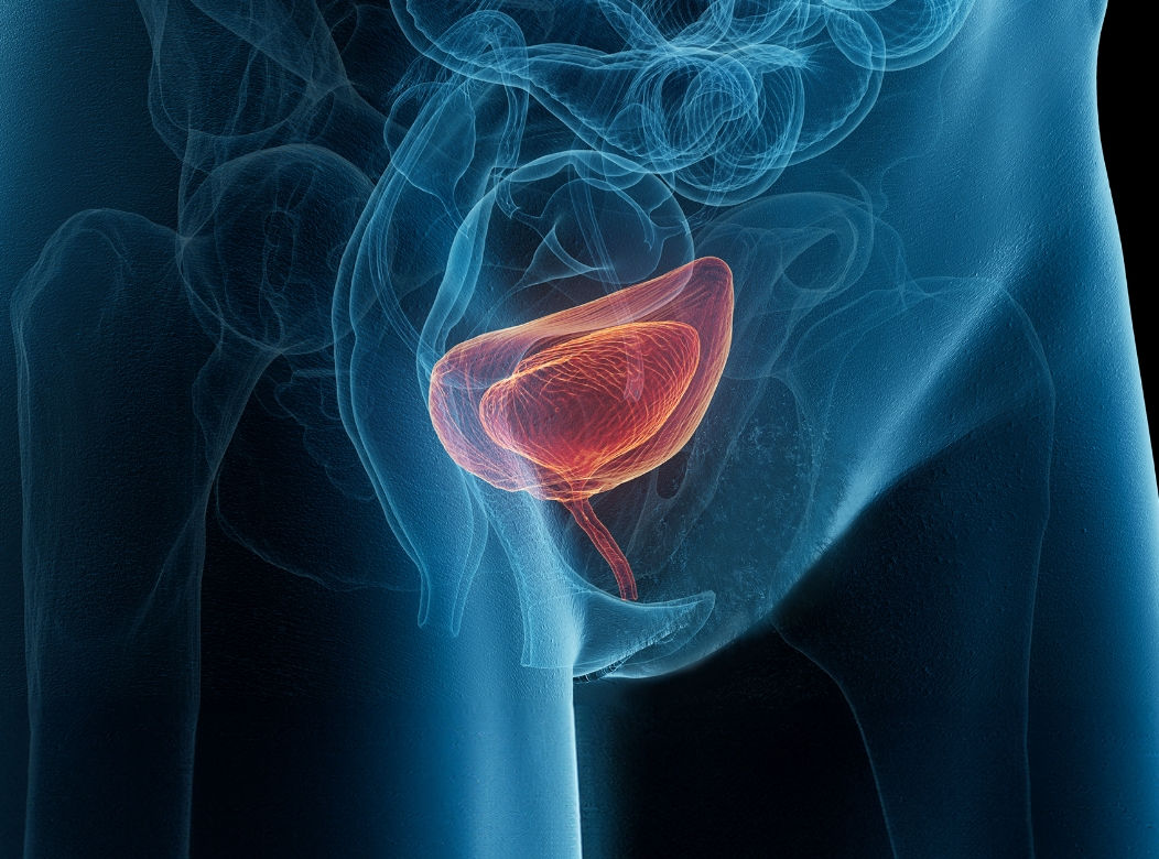 배뇨장애 클리닉