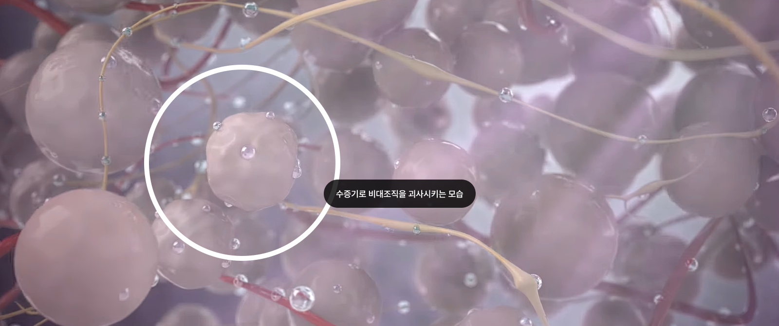 수증기로 비대조적을 괴사되는 모습