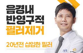음경 내 반영구 필러 제거, 20년 전 삽입 필러 제거 시술