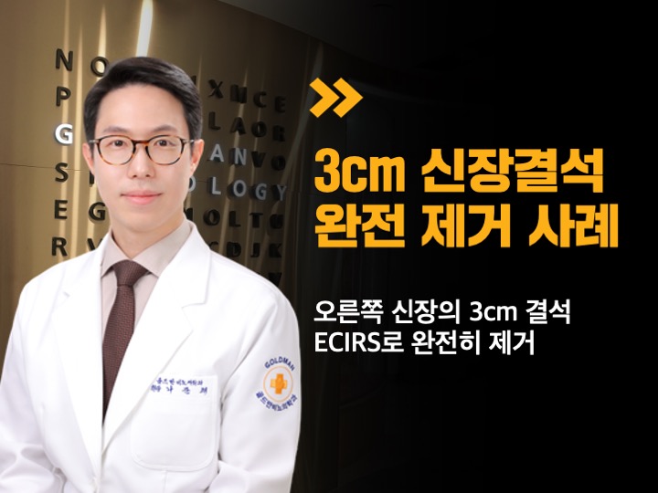 3cm 신장결석 완전 제거 사례오른쪽 신장 3cm 결석 ECIRS 제거